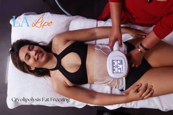 woman getting cryolipolysis Nuneaton