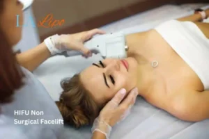Woman having Hi-Fu to reduce wrinkles Nuneaton.