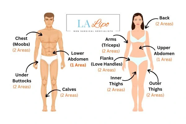 LA LIPO Cryolipolysis Areas Nuneaton