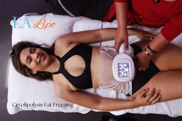 woman getting cryolipolysis Nuneaton